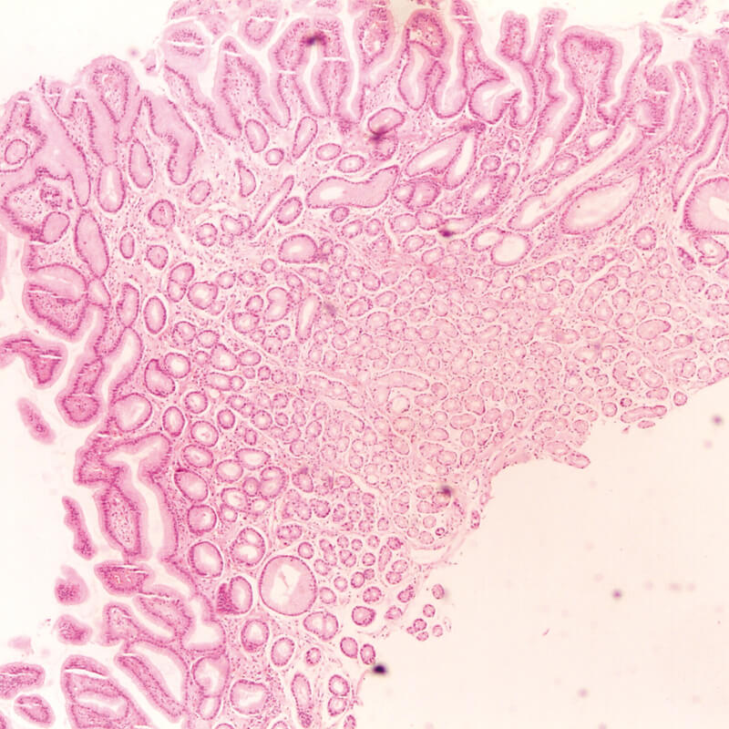 Biopsat Zange gezahnt