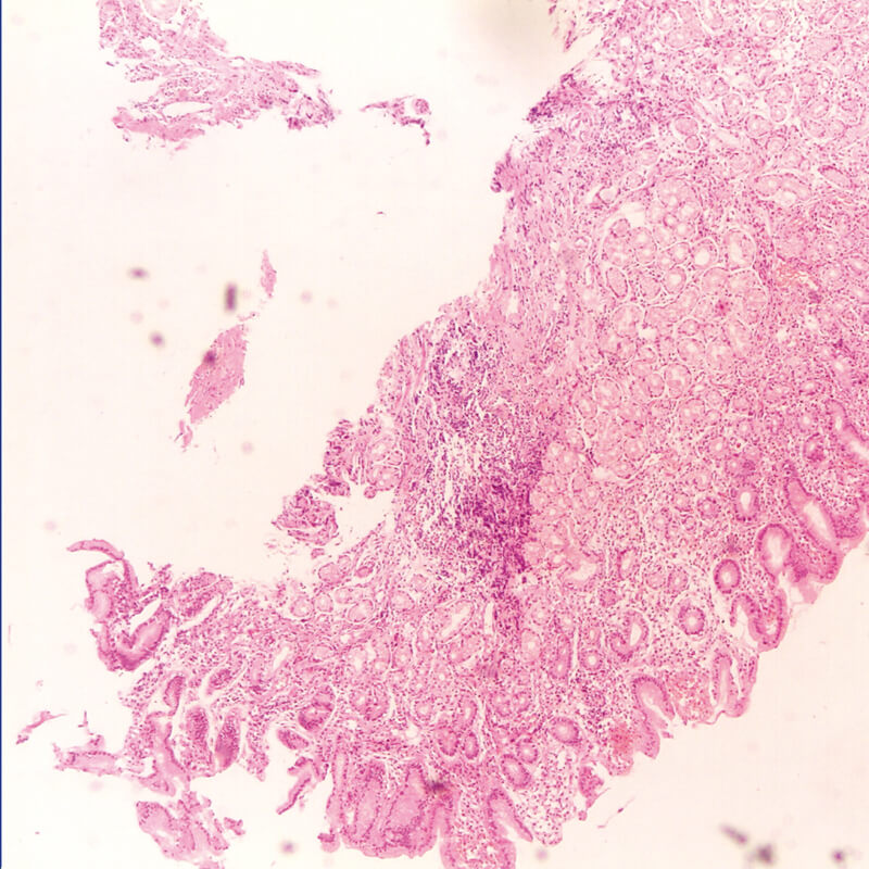 Biopsat Zange glatt