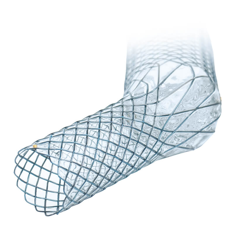 CARINA-J-STENT