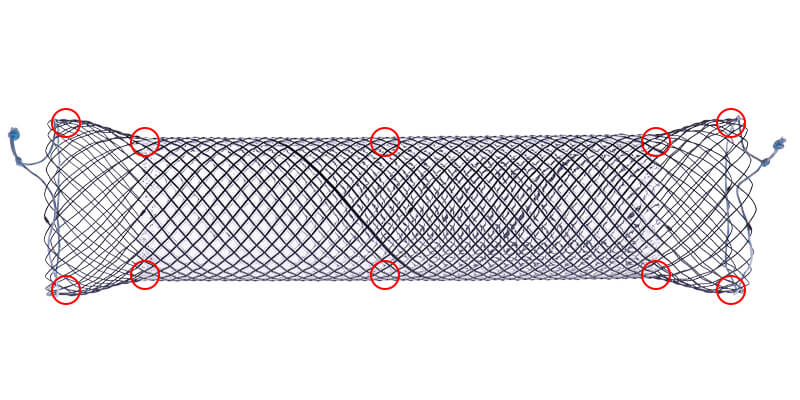Oeso_Stent_10Xray