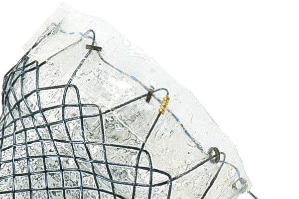 Softcup-Oeso_Stent_faden