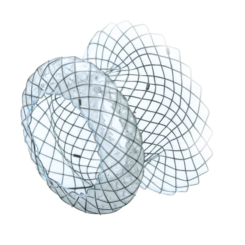 Psedozysten Stent