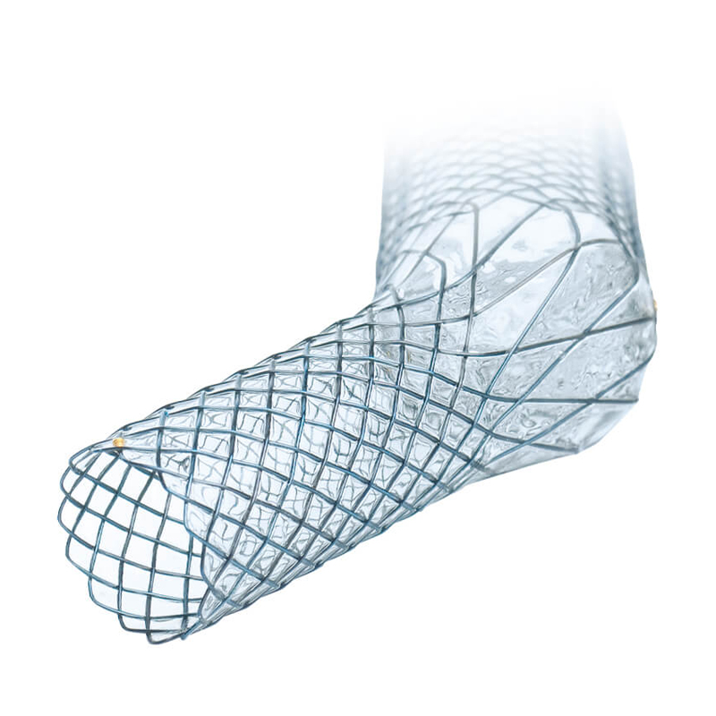 CARINA-J-STENT