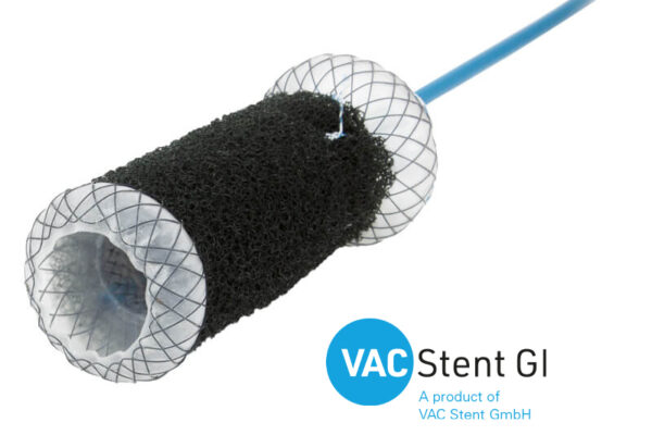 VacStent-GI
