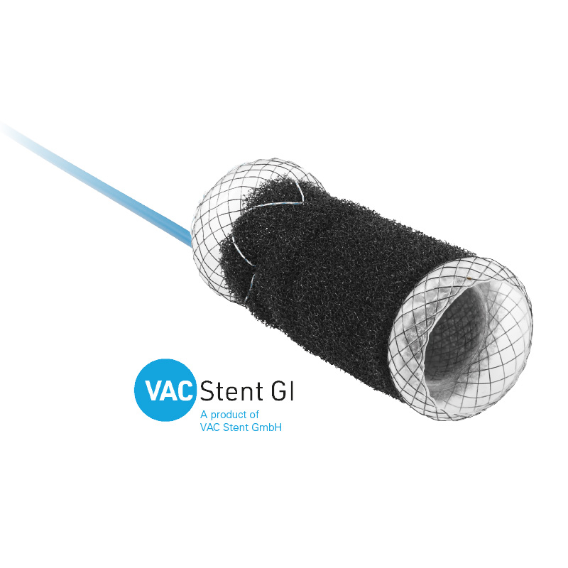 Vac Stent GI Colon