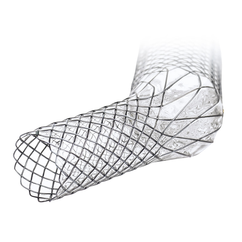 carina-j-stent-otw_EN