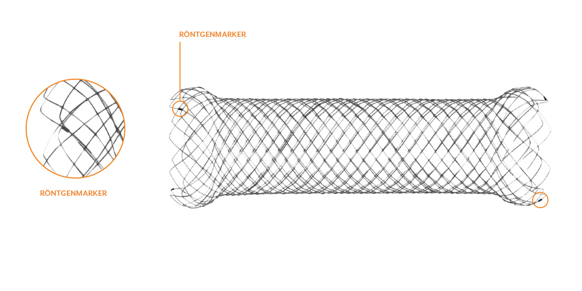 DUODENUM STENTS EIGENSCHAFTEN