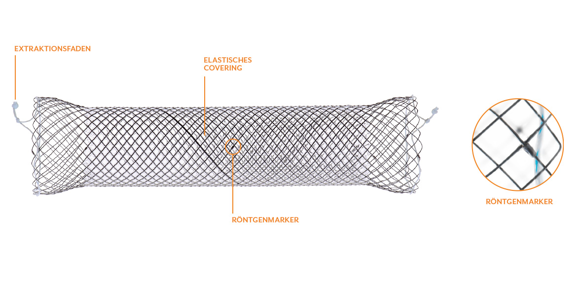 OESOPHAGUS STENTS EIGENSCHAFTEN