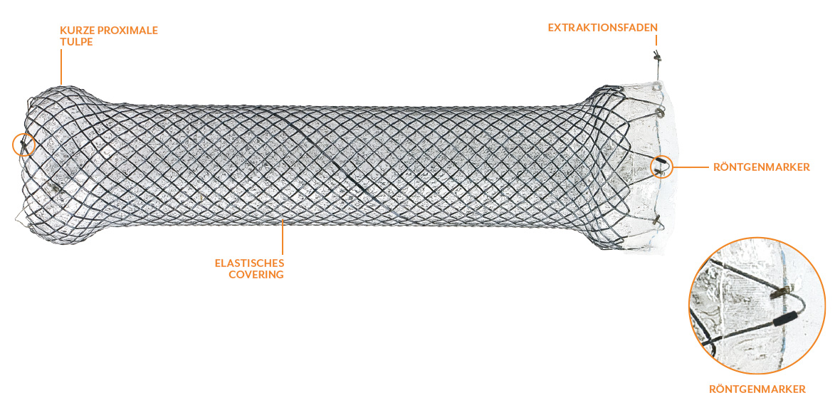 softcup oesophagus stent eigenschaften