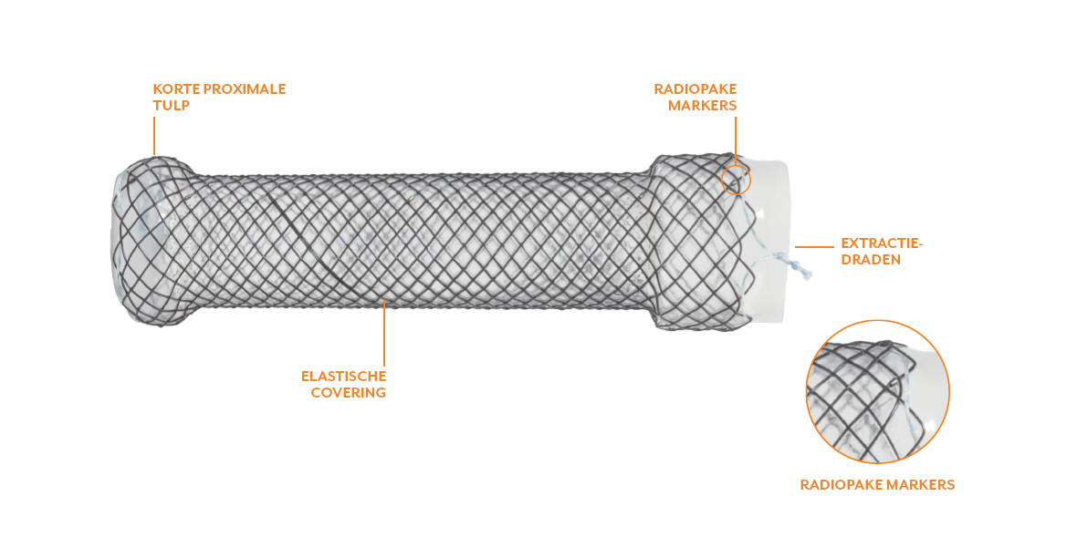 softcup oesophagus stent eigenschaften